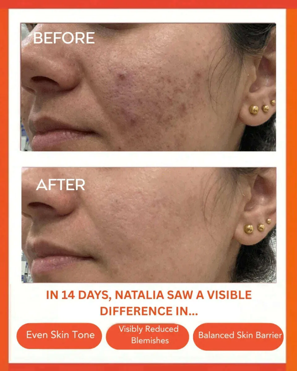 Clear Confidence Moisturizer - Refillable - Image 5